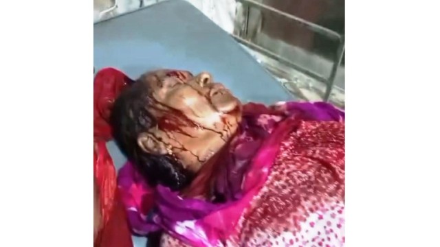 পলাশবাড়ীতে জমি সংক্রান্ত জেরে প্রতিপক্ষের ওপর হত্যার উদ্দেশ্যে হামলা 