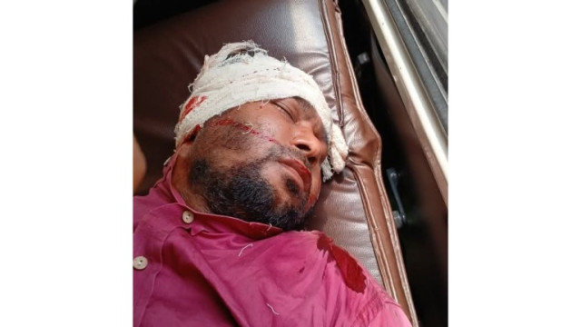পলাশবাড়ীতে বাসের হেল্পারের ধাক্কায় আহত ব্যক্তির মৃত্যু