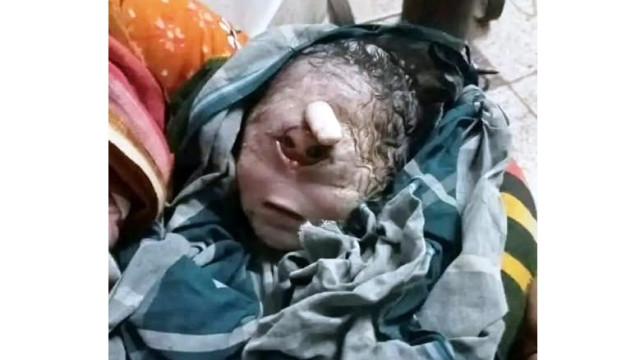 গাইবান্ধার রাবেয়া ক্লিনিকে 'আজব' শিশুর জন্ম:চাঞ্চল্যের সৃষ্টি!