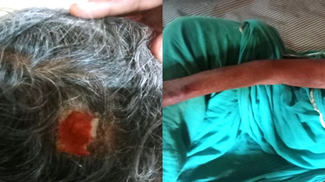 পীরগঞ্জে পুত্রবধূর মারপিটের আঘাতে শাশুড়ীসহ আহত ২